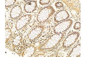 ABIN6256347 and ABIN6267658 at 1/100 staining Human normal tissues adjacent to colorectal cancer by IHC-P.