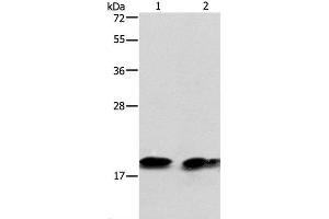 Western Blot analysis of Mouse brain tissue and NIH/3T3 cell using SKP1 Polyclonal Antibody at dilution of 1:550 (SKP1 anticorps)