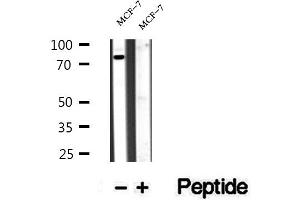 Western blot analysis of extracts of MCF-7 cells, using BBS10 antibody.