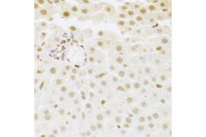 Immunohistochemistry of paraffin-embedded rat liver using SFN Antibody. (14-3-3 sigma/SFN anticorps  (AA 1-248))