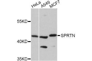 Western blot analysis of extracts of various cell lines, using SPRTN Antibody (ABIN5998942) at 1:3000 dilution. (Spartan anticorps)