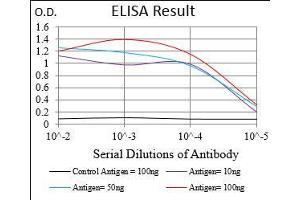 Black line: Control Antigen (100 ng), Purple line: Antigen(10 ng), Blue line: Antigen (50 ng), Red line: Antigen (100 ng),