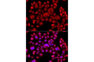 Immunofluorescence analysis of A549 cells using PIP4K2B antibody. (PIP4K2B anticorps)