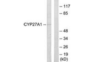 Western blot analysis of extracts from HeLa cells, using Cytochrome P450 27A1 Antibody. (CYP27A1 anticorps  (AA 101-150))
