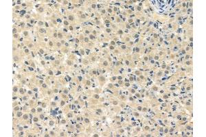 ABIN7093263 and ABIN7097282 at 1/100 staining Rat ovarian tissue by IHC-P. (HSF1 anticorps  (pThr142))