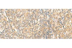 Immunohistochemistry of paraffin-embedded Human tonsil tissue using GRIA4 Polyclonal Antibody at dilution of 1:35(x200) (GRIA4 anticorps)