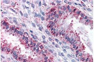 Anti-DPEP1 antibody  ABIN960762 IHC staining of human uterus.