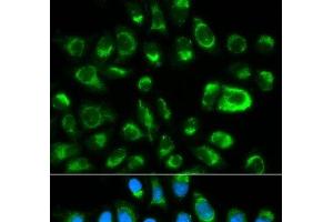 Immunofluorescence analysis of HeLa cells using GAS2 Polyclonal Antibody (GAS2 anticorps)