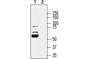 Western blot analysis of human PANC-1 pancreas ductal adenocarcinoma cell line lysate: - 1.