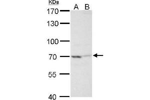 WB Image TNF alpha IP2 antibody detects TNF alpha IP2 protein by Western blot analysis. (TNIP2 anticorps  (Center))