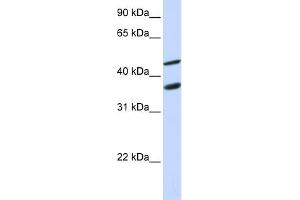 WB Suggested Anti-GAS7 Antibody Titration:  0. (GAS7 anticorps  (N-Term))