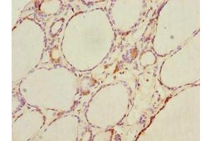 Immunohistochemistry of paraffin-embedded human thyroid tissue using ABIN7164417 at dilution of 1:100 (DTX2 anticorps  (AA 1-280))