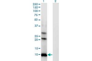 Western Blot analysis of AKR1CL1 expression in transfected 293T cell line by AKR1CL1 monoclonal antibody (M04), clone 4G8. (AKR1CL1 anticorps  (AA 1-129))