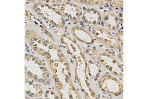 Immunohistochemistry of paraffin-embedded human kidney using PDGFRB antibody at dilution of 1:200 (x400 lens) (PDGFRB anticorps)