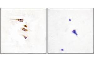 Immunohistochemistry analysis of paraffin-embedded human brain tissue, using EPHA6 Antibody.