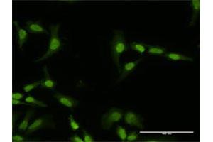 Immunofluorescence of purified MaxPab antibody to PI4K2A on HeLa cell.