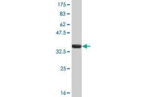 Western Blot detection against Immunogen (37.