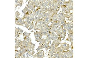 Immunohistochemistry of paraffin-embedded human tonsil using CDK1 Rabbit mAb (ABIN7266576) at dilution of 1:100 (40x lens).