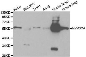 Western blot analysis of extracts of various cell lines, using PPP3CA antibody. (PPP3CA anticorps  (AA 1-511))