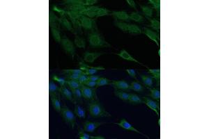 Immunofluorescence analysis of C6 cells using D Polyclonal Antibody (ABIN7266712) at dilution of 1:100 (40x lens). (DAPK3 anticorps  (AA 1-100))