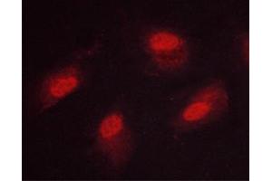 ABIN6267669 staining HeLa cells by ICC/IF. (CAMK4 anticorps  (pThr200))