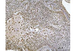 IHC analysis of Ataxin 1 using anti-Ataxin 1 antibody (ABIN7602773).