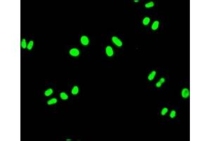 Immunofluorescence staining of Hela Cells with ABIN7127503 at 1:50, counter-stained with DAPI. (Recombinant FUBP1 anticorps)