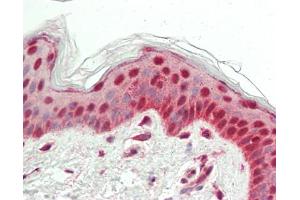 Human Skin: Formalin-Fixed, Paraffin-Embedded (FFPE)
