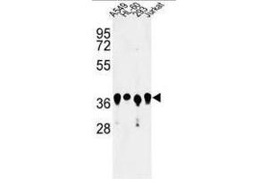 Western blot analysis of ARGLU1 Antibody (N-term) in A549, HL-60, 293, Jurkat cell line lysates (35µg/lane). (ARGLU1 anticorps  (N-Term))