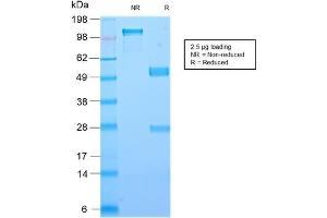 SDS-PAGE Analysis Purified Galectin-1 Monospecific Recombinant Rabbit Monoclonal Antibody (GAL1/2499R).