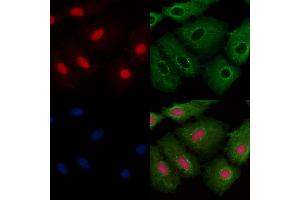 ABIN6256824 and ABIN6273425 staining  cells by IF/ICC.