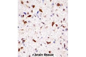 Immunohistochemistry (IHC) image for anti-Homeobox A7 (HOXA7) antibody (ABIN2998012)