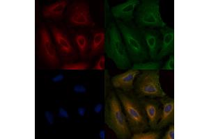 ABIN6264219 and ABIN6279663 staining  cells by IF/ICC.