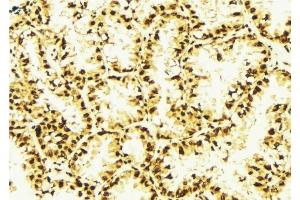 ABIN6277069 at 1/100 staining Human lung tissue by IHC-P. (HDAC2 anticorps  (Internal Region))