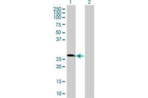 Western Blot analysis of ZNF266 expression in transfected 293T cell line by ZNF266 MaxPab polyclonal antibody. (ZNF266 anticorps  (AA 1-263))