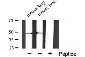 Western blot analysis of Phospho-HDAC3 (Ser424) Antibody expression in mouse lung and mouse brain tissues lysates. (HDAC3 anticorps  (pSer424))