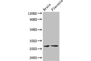 Western Blot Positive WB detected in: Mouse brain tissue, Human placenta tissue All lanes: FBXL22 antibody at 3 μg/mL Secondary Goat polyclonal to rabbit IgG at 1/50000 dilution Predicted band size: 28 kDa Observed band size: 28 kDa (FBXL22 anticorps  (AA 123-229))