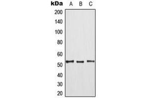 Western blot analysis of TPL2 (pT290) expression in HepG2 (A), mouse liver (B), rat liver (C) whole cell lysates. (MAP3K8 anticorps  (pSer290))