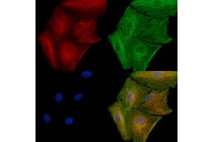 ABIN6261126 and ABIN6277912 staining  cells by IF/ICC. (CXCR1 anticorps  (N-Term))