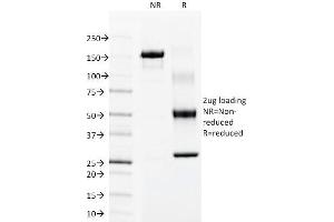 SDS-PAGE Analysis Purified Cytokeratin 15 Mouse Monoclonal Antibody (LHK15). (KRT15 anticorps  (C-Term))
