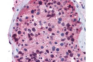 Immunohistochemistry (IHC) image for anti-Forkhead Box O1 (FOXO1) (Middle Region) antibody (ABIN2777689)