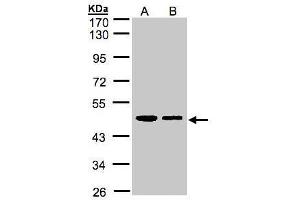 WB Image Sample(30 ug whole cell lysate) A:A431, B:H1299 10% SDS PAGE antibody diluted at 1:1000 (ERP44 anticorps)