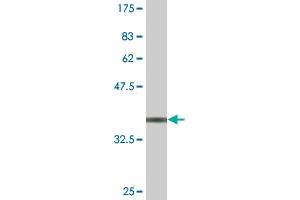 Western Blot detection against Immunogen (38. (JNK anticorps  (AA 318-427))