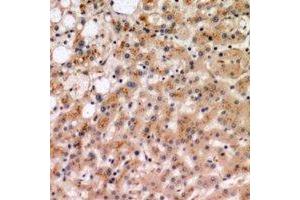 Immunohistochemical analysis of IL-19 staining in human liver formalin fixed paraffin embedded tissue section. (IL-19 anticorps)