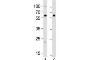 Western blot analysis of lysate from 1) human 293 and 2) mouse NIH3T3 cell line using BMPR1A antibody at 1:1000. (BMPR1A anticorps  (AA 166-196))