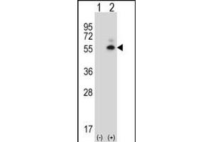 Western blot analysis of Camk2d (arrow) using rabbit polyclonal Mouse Camk2d Antibody (Center) (ABIN657721 and ABIN2846708).