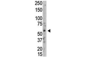 Western blot analysis of PRMT3 antibody and whole HL-60 cell lysate.