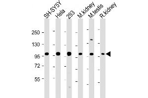 All lanes : Anti-PG Antibody (N-Term) at 1:2000 dilution Lane 1: SH-SY5Y whole cell lysate Lane 2: Hela whole cell lysate Lane 3: 293 whole cell lysate Lane 4: mouse kidney lysate Lane 5: mouse testis lysate Lane 6: rat kidney lysate Lysates/proteins at 20 μg per lane. (PGAP1 anticorps  (AA 90-122))