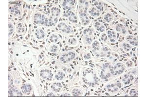 Immunohistochemical staining of paraffin-embedded breast tissue using anti-VEGF mouse monoclonal antibody. (VEGF anticorps  (AA 27-233))