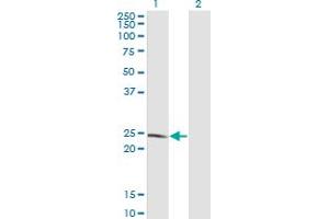 Western Blot analysis of LYPLA1 expression in transfected 293T cell line by LYPLA1 monoclonal antibody (M05), clone 3D5. (LYPLA1 anticorps  (AA 66-151))